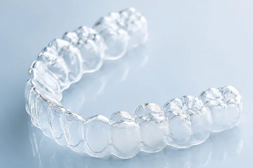 clear aligners suresmile